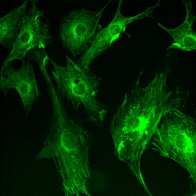 Application of sCMOS Scientific Cameras in Widefield Fluorescence Imaging