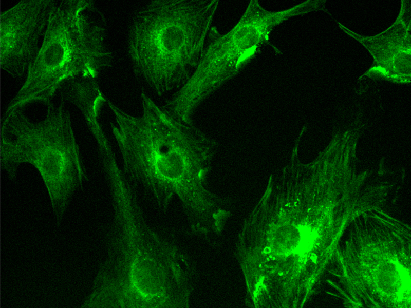 Anwendung von sCMOS-Wissenschaftskameras in der Weitfeld-Fluoreszenzbildgebung