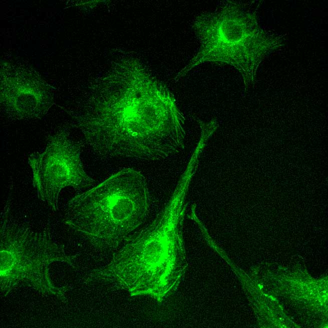 application of scmos scientific cameras in widefield fluorescence imaging 2 application of scmos scientific cameras in widefield fluorescence imaging 2