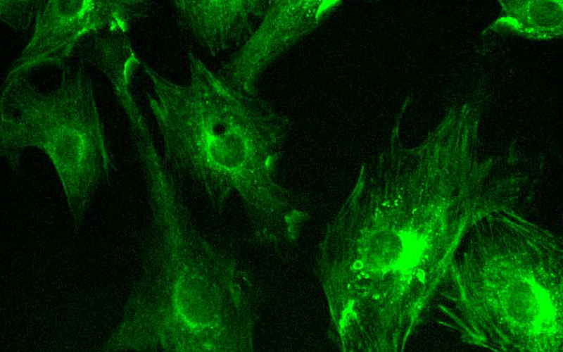 Anwendung von sCMOS wissenschaft lichen Kameras in der Wide field Fluoreszenz Imaging