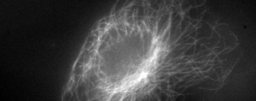 scmos-camera-equipped-with-sim-super-resolution-microscope-2.jpg scmos-camera-equipped-with-sim-super-resolution-microscope-2.jpg